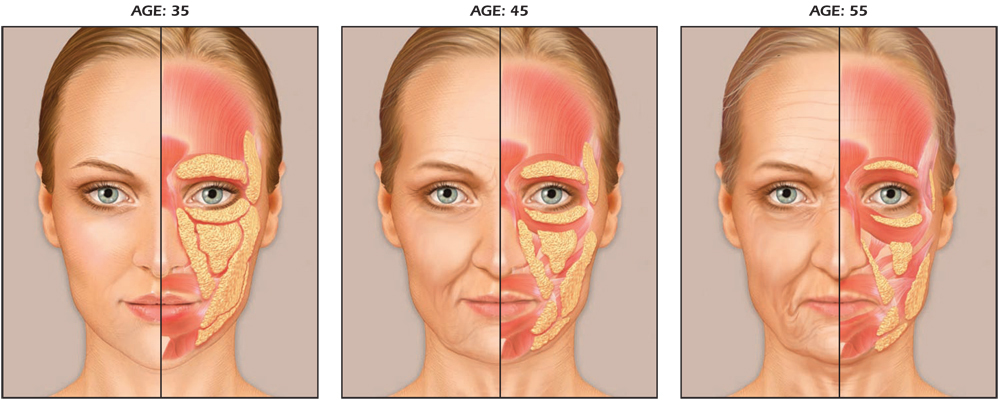 The facial ageing process